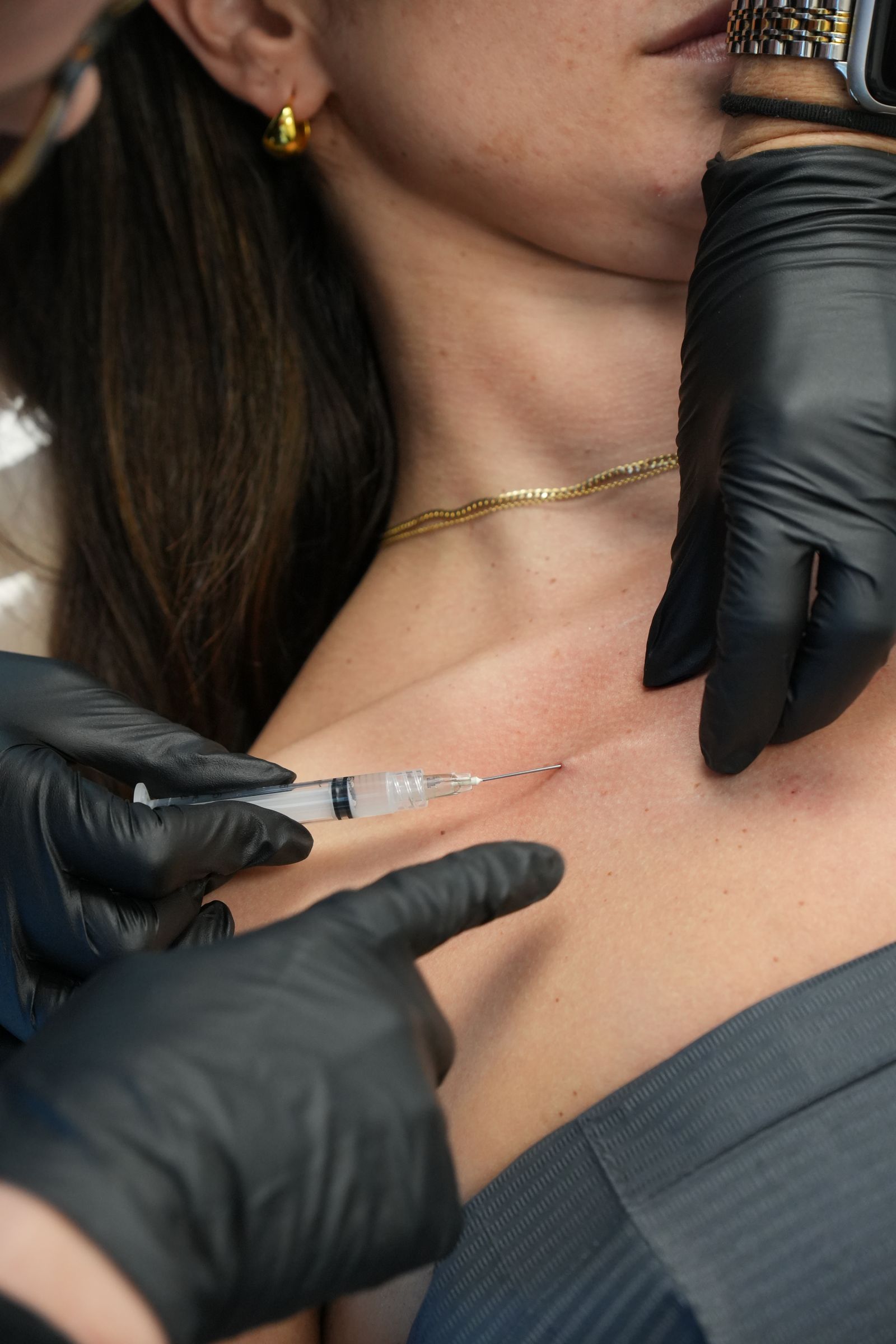 Dr. Parsa performing an injectable treatment