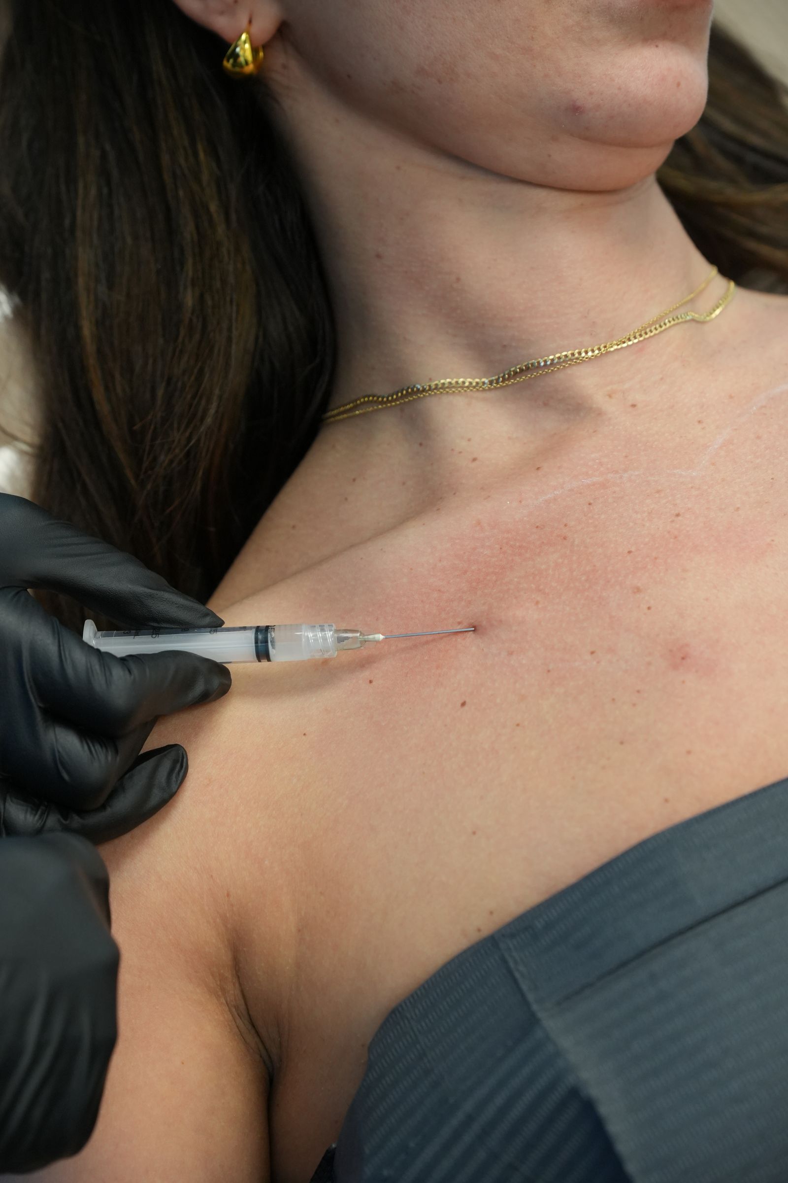 Dr. Parsa performing a treatment